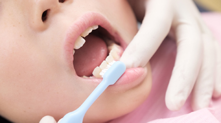子供の虫歯予防